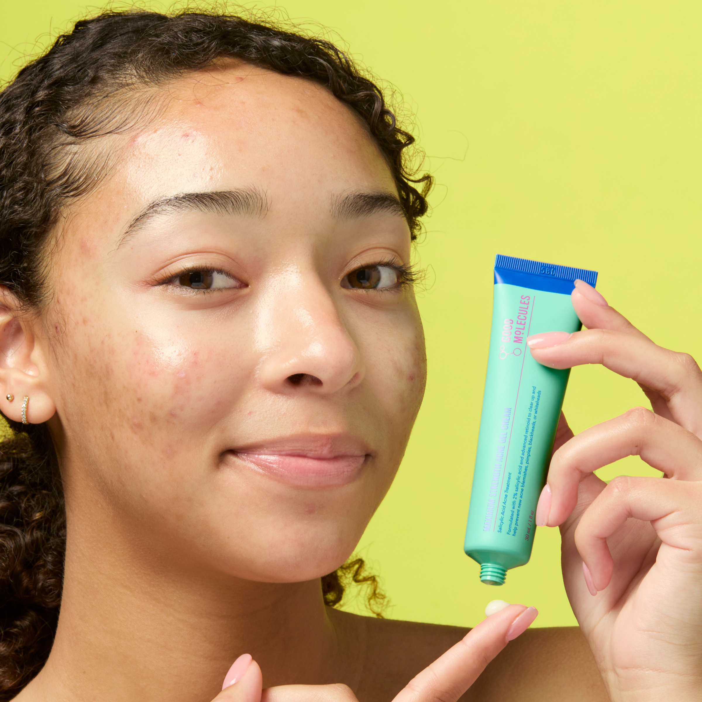 Maximum Strength Acne Gel Cream